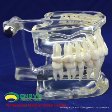 DENTAL11 (12571) Humano Adulto Natural Tamanho Transparente Padrão Dental Ensinar Modelos